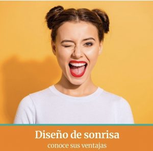 diseño de sonrisa