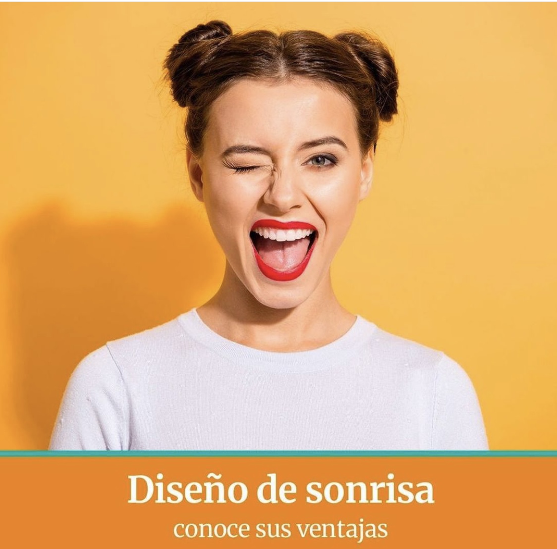 diseño de sonrisa