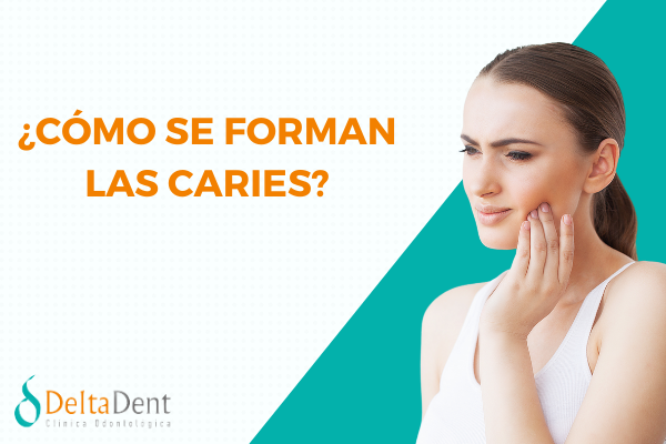 ¿COMO SE FORMAN LAS CARIES