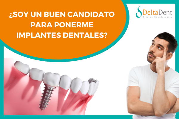 implantes dentales